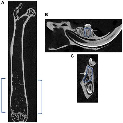 Methylsulfonylmethane Increases the Alveolar Bone Density of Mandibles in Aging Female Mice